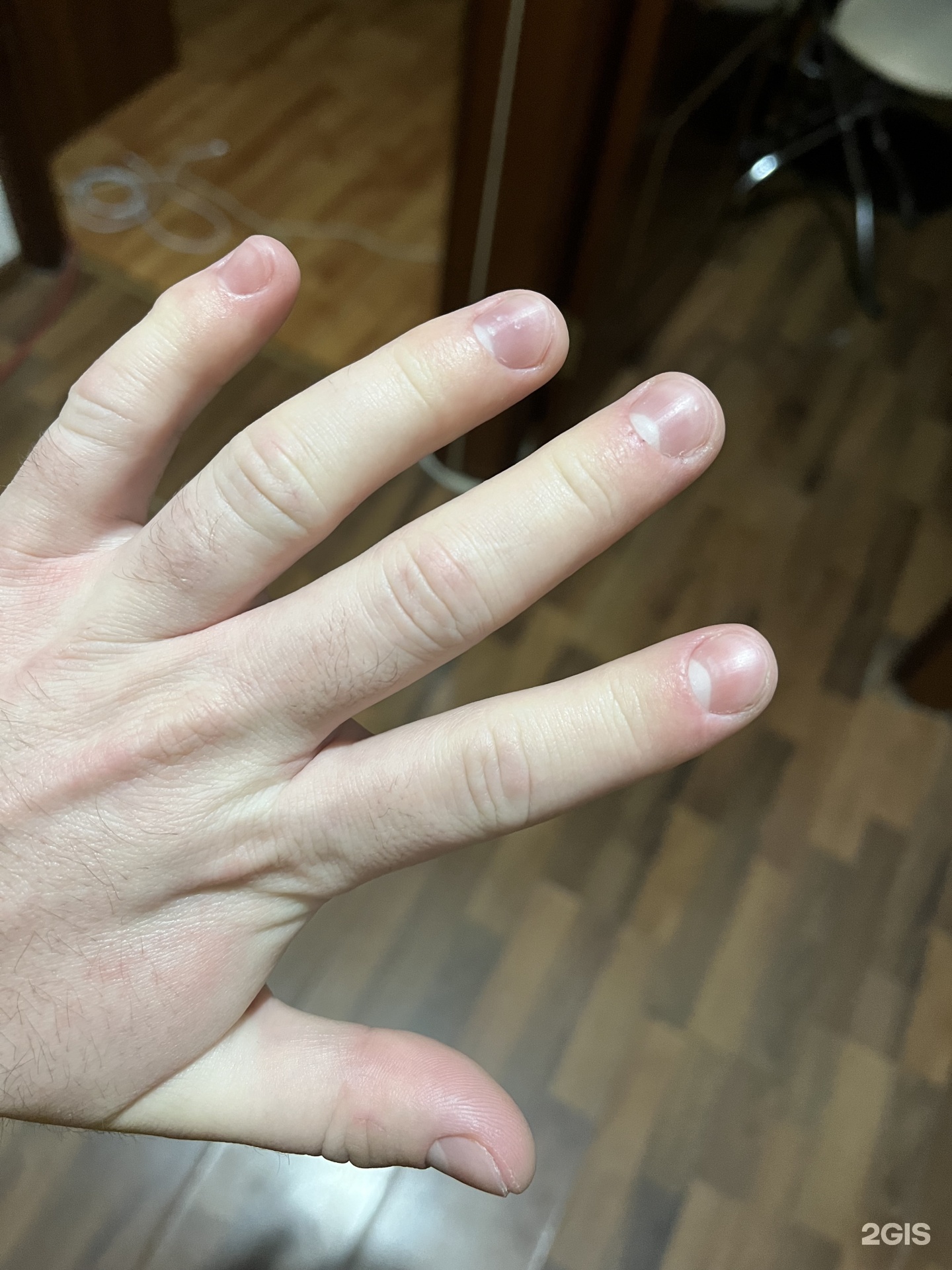 Anyone know how to deal with this? : r/AcrylicNails